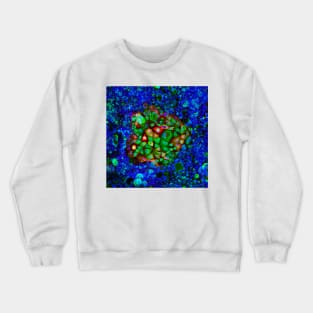 Colorectal cancer cells, light micrograph (C021/6371) Crewneck Sweatshirt